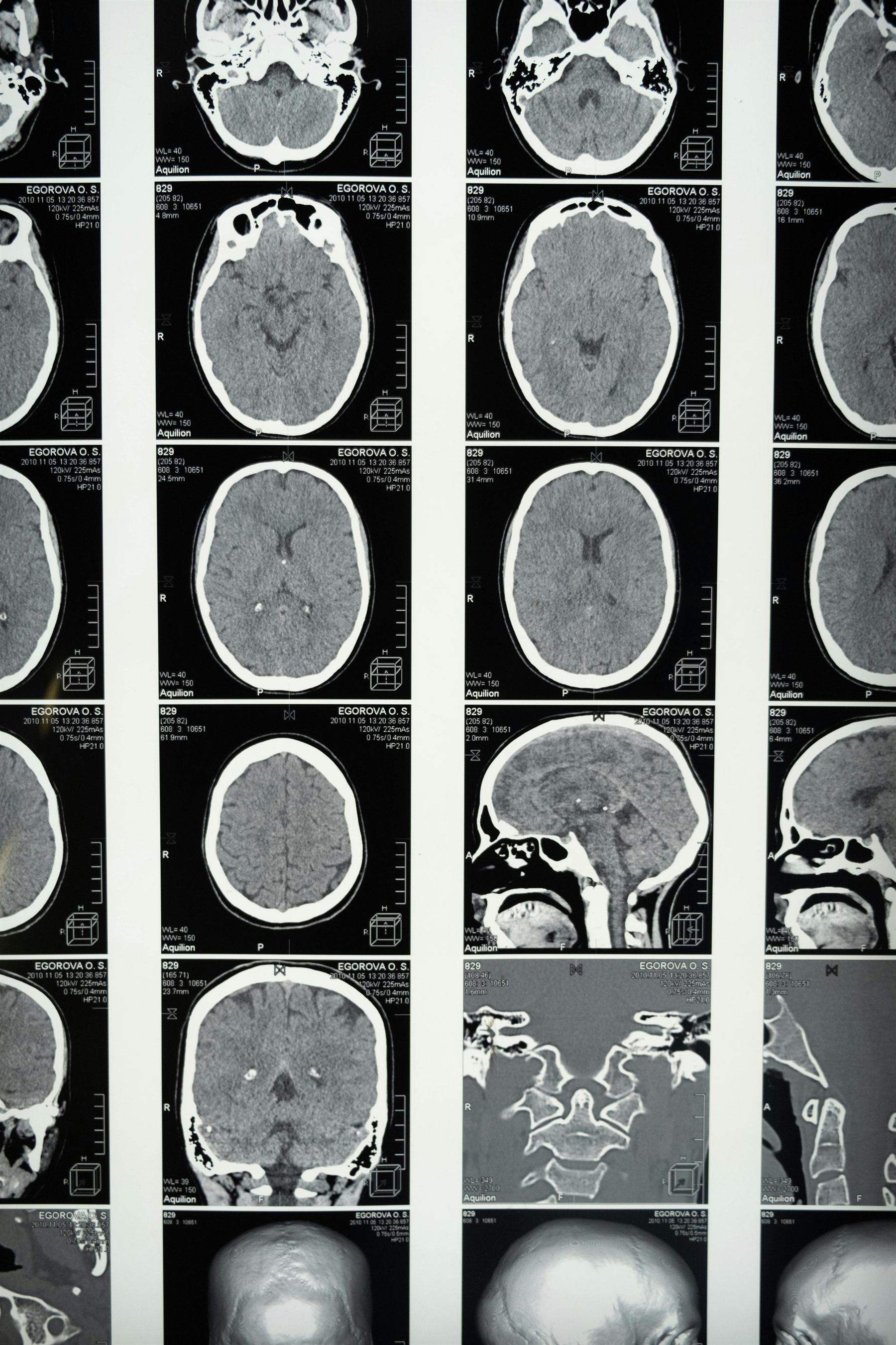 Advanced Brain & Nervous System Recovery at Integrative Health Solutions in Florence SC